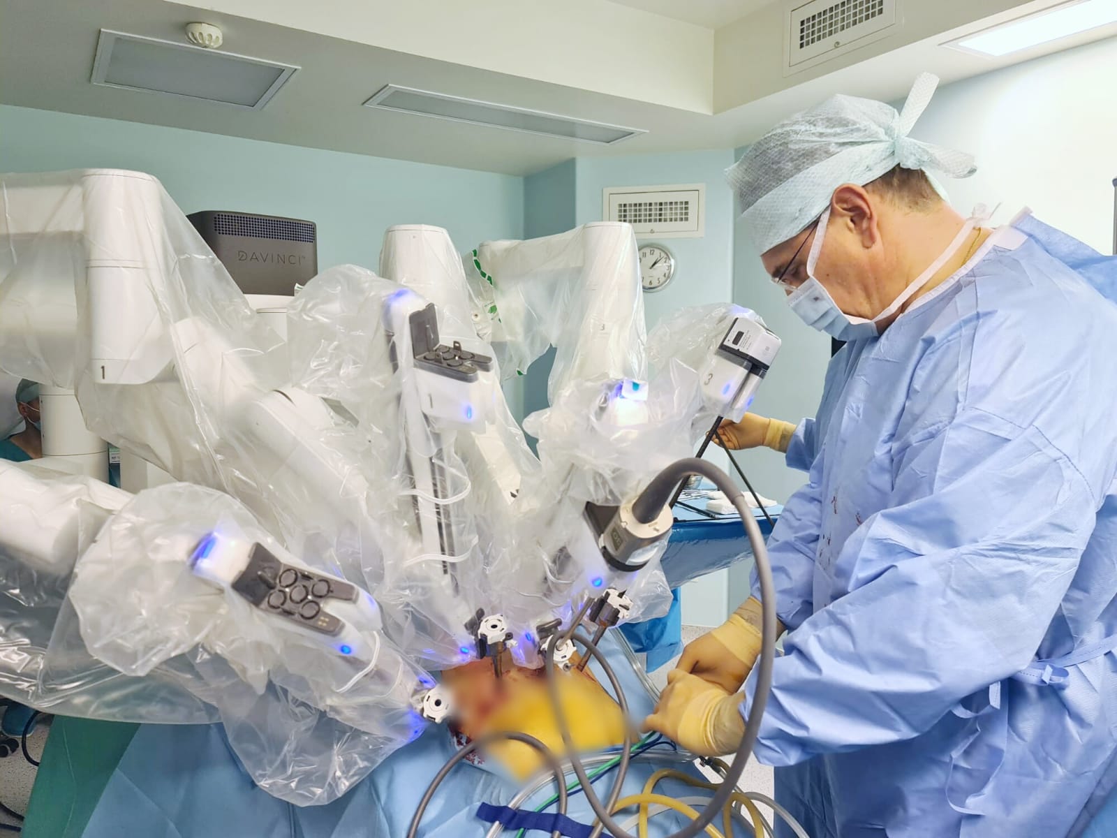 MedLife investește în continuare în domeniul chirurgiei robotice și achiziționează robotul da Vinci X în cadrul Spitalului MedLife Polisano din Sibiu MedLife investește în continuare în domeniul chirurgiei robotice și achiziționează robotul da Vinci X în cadrul Spitalului MedLife Polisano din Sibiu