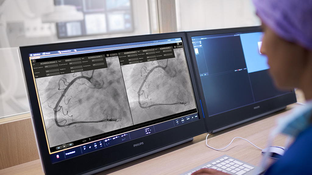 Inovație în cardiologie: Philips lansează tehnologia care reduce la jumătate doza de radiație X în timpul intervențiilor pe inimă